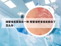 抹婴宝皮肤变白一块 擦婴宝把宝宝皮肤白了怎么办