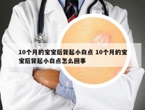 10个月的宝宝后背起小白点 10个月的宝宝后背起小白点怎么回事