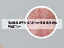 得过银屑病可以打九价hpv疫苗 银屑病能不能打hpv