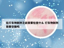 在打生物制剂之前需要检查什么 打生物制剂需要空腹吗