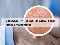 大腿根内侧长了一些像癣一样的图片 大腿根内侧长了一块癣特别痒