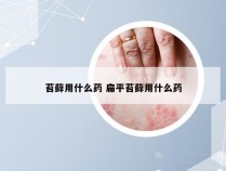 苔藓用什么药 扁平苔藓用什么药