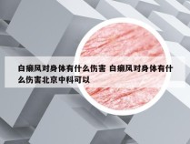 白癞风对身体有什么伤害 白癞风对身体有什么伤害北京中科可以