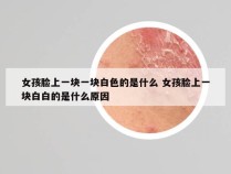 女孩脸上一块一块白色的是什么 女孩脸上一块白白的是什么原因