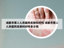 成都市第二人民医院皮肤科好吗 成都市第二人民医院皮肤科好吗多少钱