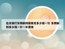 在济源打生物制剂报销完多少钱一针 生物制剂多少钱一针一年费用