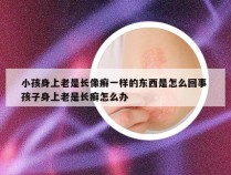 小孩身上老是长像癣一样的东西是怎么回事 孩子身上老是长癣怎么办