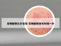 生物制剂几针见效 生物制剂多长时间一针