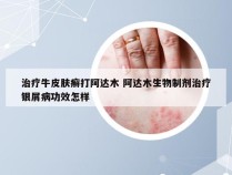 治疗牛皮肤癣打阿达木 阿达木生物制剂治疗银屑病功效怎样