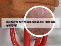 银屑病吃复方苦木消炎胶囊管用吗 银屑病能吃苦瓜吗?