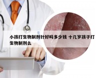 小孩打生物制剂针好吗多少钱 十几岁孩子打生物制剂么