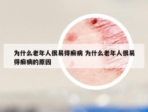 为什么老年人很易得癣病 为什么老年人很易得癣病的原因