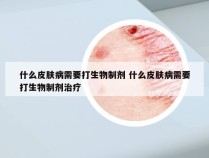 什么皮肤病需要打生物制剂 什么皮肤病需要打生物制剂治疗