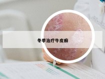 冬季治疗牛皮癣