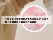 小伙子身上有癣用什么偏方治疗最好 小伙子身上有癣用什么偏方治疗最好呢