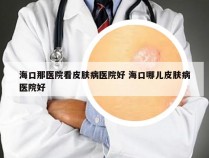 海口那医院看皮肤病医院好 海口哪儿皮肤病医院好