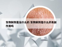 生物制剂是治什么的 生物制剂是什么药有副作用吗