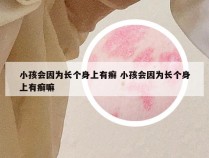 小孩会因为长个身上有癣 小孩会因为长个身上有癣嘛