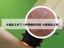 小腿肚上长了一块像癣的东西 小腿腿肚上长