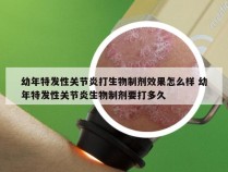 幼年特发性关节炎打生物制剂效果怎么样 幼年特发性关节炎生物制剂要打多久