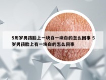 5周岁男孩脸上一块白一块白的怎么回事 5岁男孩脸上有一块白的怎么回事