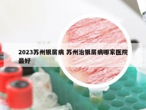 2023苏州银屑病 苏州治银屑病哪家医院最好