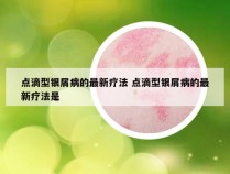 点滴型银屑病的最新疗法 点滴型银屑病的最新疗法是