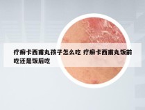 疗癣卡西甫丸孩子怎么吃 疗癣卡西甫丸饭前吃还是饭后吃