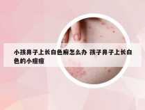 小孩鼻子上长白色癣怎么办 孩子鼻子上长白色的小痘痘