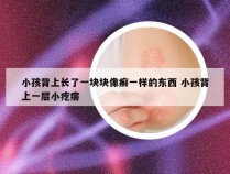 小孩背上长了一块块像癣一样的东西 小孩背上一层小疙瘩