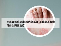 小孩脚长癣,越长越大怎么办 小孩脚上有癣用什么药膏治疗