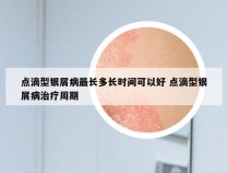 点滴型银屑病最长多长时间可以好 点滴型银屑病治疗周期