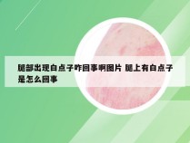 腿部出现白点子咋回事啊图片 腿上有白点子是怎么回事