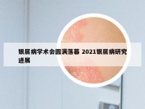 银屑病学术会圆满落幕 2021银屑病研究进展