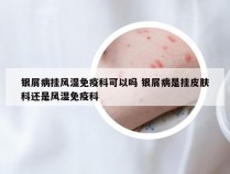 银屑病挂风湿免疫科可以吗 银屑病是挂皮肤科还是风湿免疫科