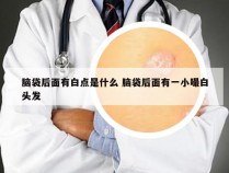 脑袋后面有白点是什么 脑袋后面有一小嘬白头发