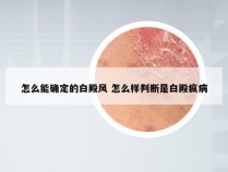 怎么能确定的白殿风 怎么样判断是白殿疯病