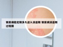 银屑病稳定期多久进入消退期 银屑病消退期过程图