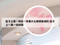 肚子上黑一块白一块是什么原因造成的 肚子上一黑一白的斑