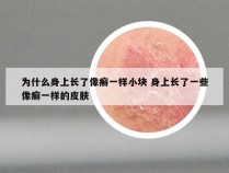 为什么身上长了像癣一样小块 身上长了一些像癣一样的皮肤