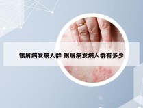 银屑病发病人群 银屑病发病人群有多少