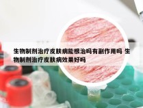 生物制剂治疗皮肤病能根治吗有副作用吗 生物制剂治疗皮肤病效果好吗