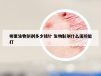 哪里生物制剂多少钱针 生物制剂什么医院能打