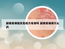 副银屑病提高免疫力有用吗 副银屑病用什么药