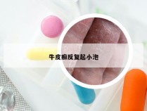 牛皮癣反复起小泡