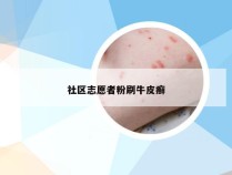 社区志愿者粉刷牛皮癣