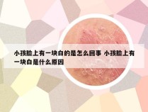 小孩脸上有一块白的是怎么回事 小孩脸上有一块白是什么原因