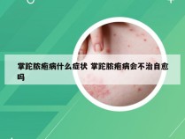 掌跎脓疱病什么症状 掌跎脓疱病会不治自愈吗