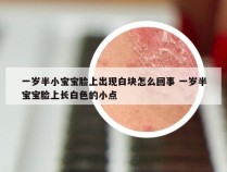 一岁半小宝宝脸上出现白块怎么回事 一岁半宝宝脸上长白色的小点