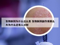 生物制剂为什么这么贵 生物制剂副作用那么大为什么还有人注射